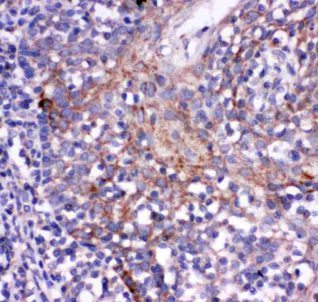 CD244 Antibody in Immunohistochemistry (Paraffin) (IHC (P))