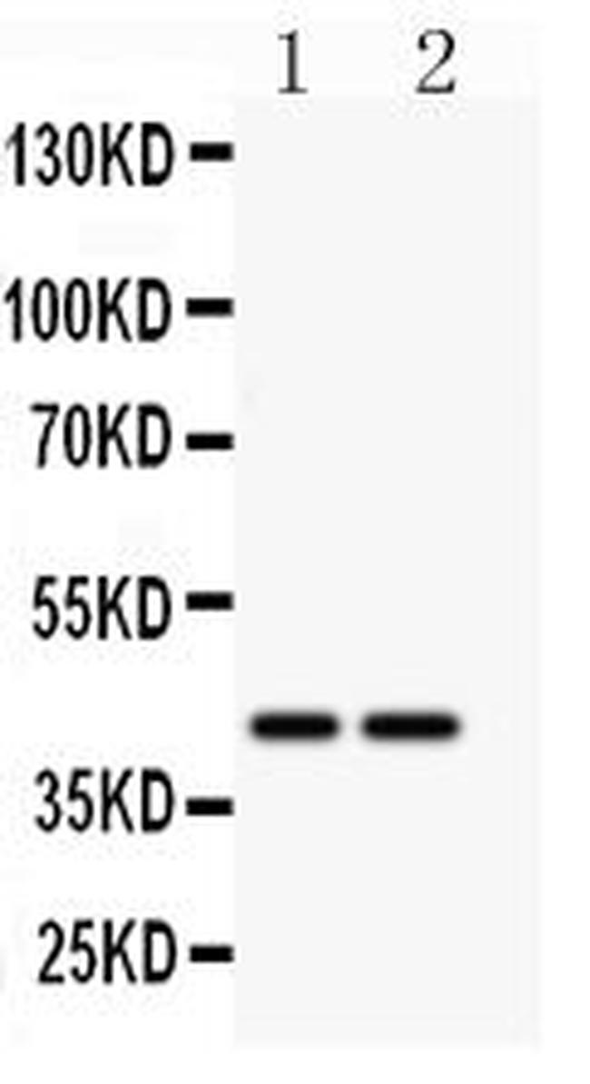 CD244 Antibody in Western Blot (WB)