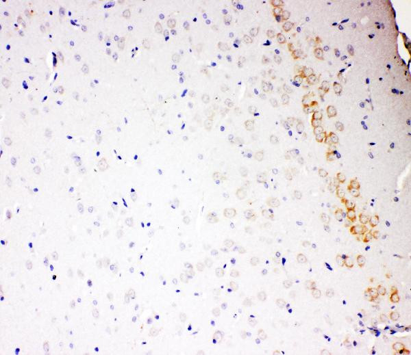 ALDH2 Antibody in Immunohistochemistry (Paraffin) (IHC (P))