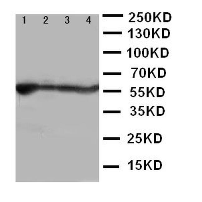 ALDH2 Antibody in Western Blot (WB)