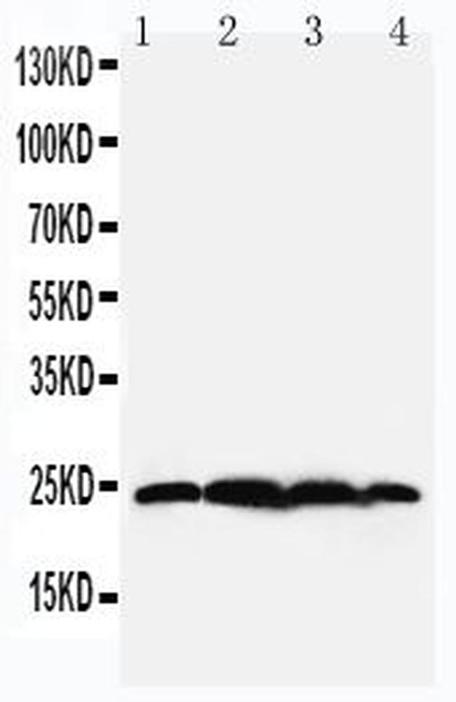 BAG2 Antibody in Western Blot (WB)