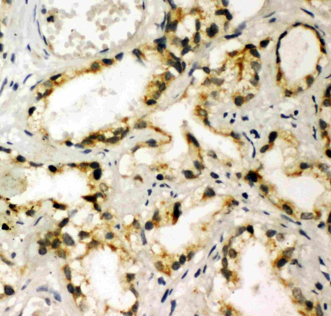 TBK1 Antibody in Immunohistochemistry (Paraffin) (IHC (P))