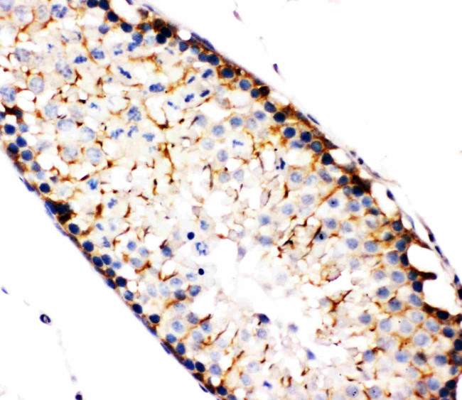 TBK1 Antibody in Immunohistochemistry (Paraffin) (IHC (P))