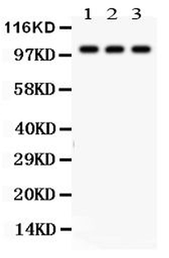 TBK1 Antibody in Western Blot (WB)