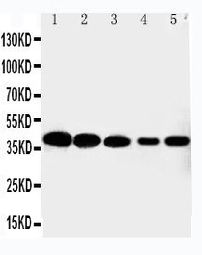 CDK7 Antibody in Western Blot (WB)