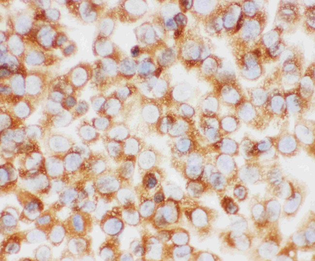 Collagen I Antibody in Immunocytochemistry (ICC/IF)