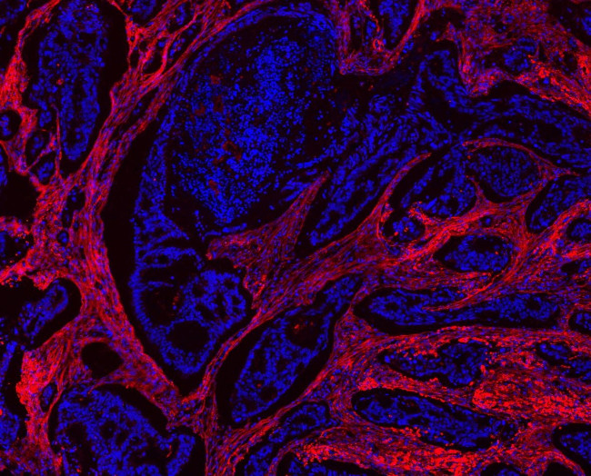 Collagen I Antibody in Immunohistochemistry (Paraffin) (IHC (P))