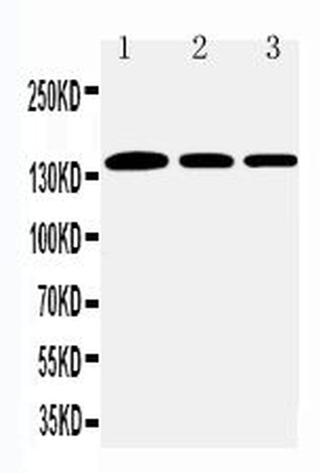 Collagen I Antibody in Western Blot (WB)