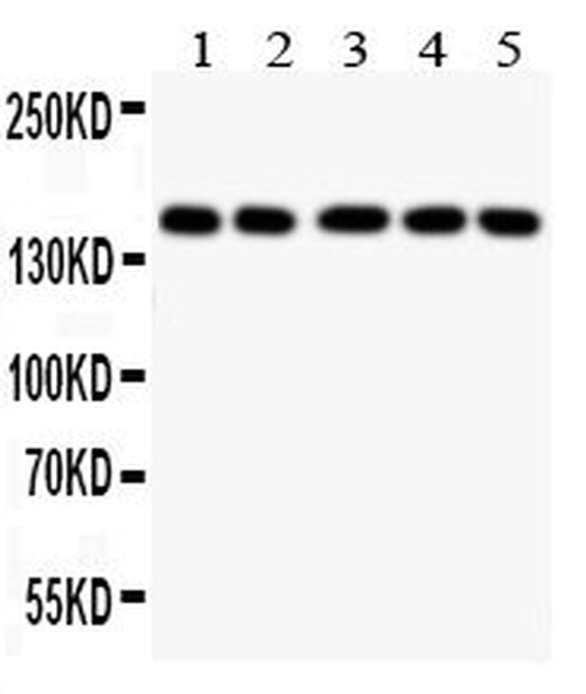 Collagen II Antibody in Western Blot (WB)