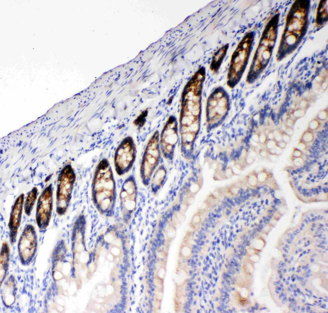 NKCC1 Antibody in Immunohistochemistry (Paraffin) (IHC (P))