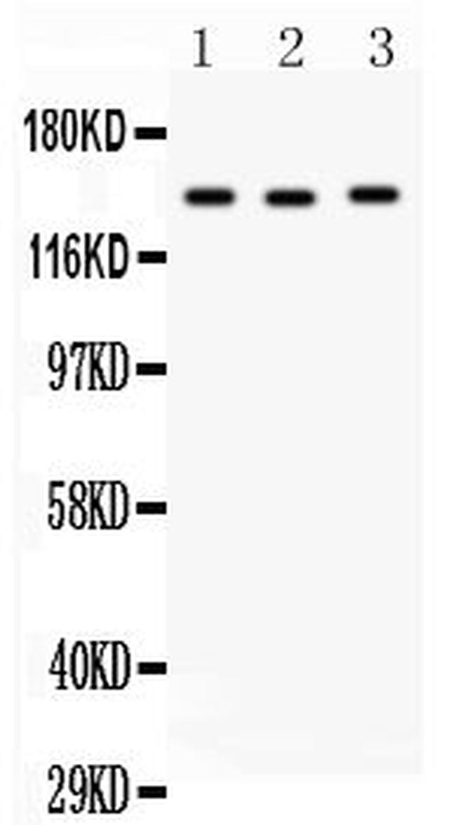 ACE Antibody in Western Blot (WB)