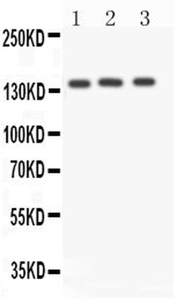 ACE Antibody in Western Blot (WB)