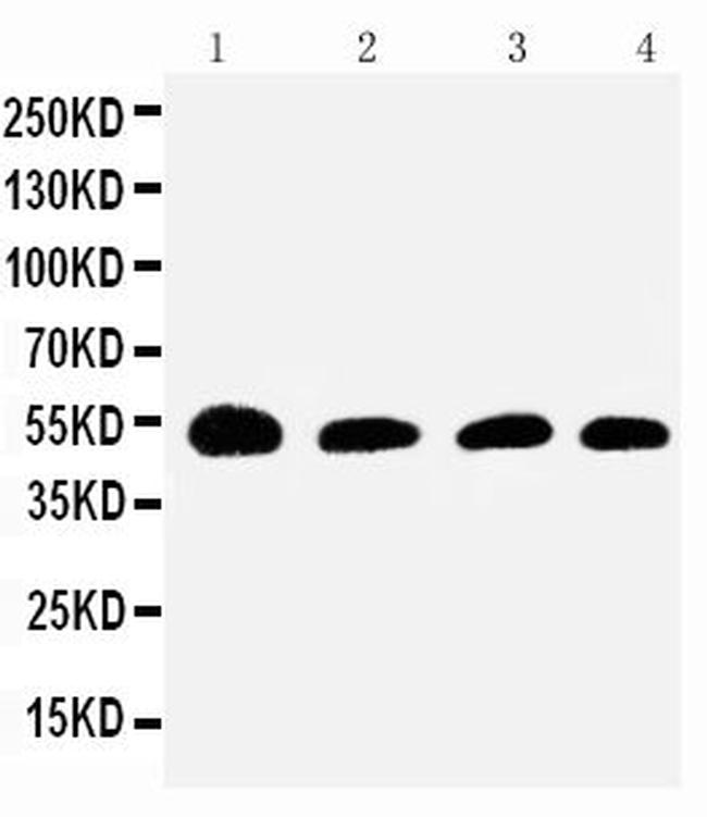 SERPINC1 Antibody in Western Blot (WB)