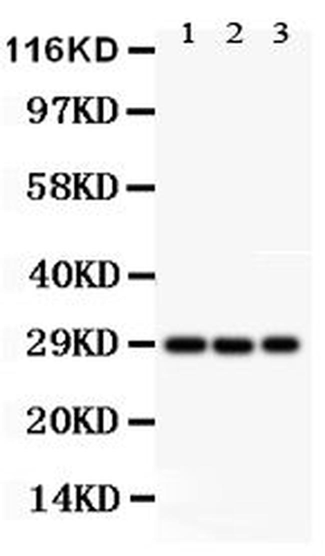 KChIP3 Antibody in Western Blot (WB)