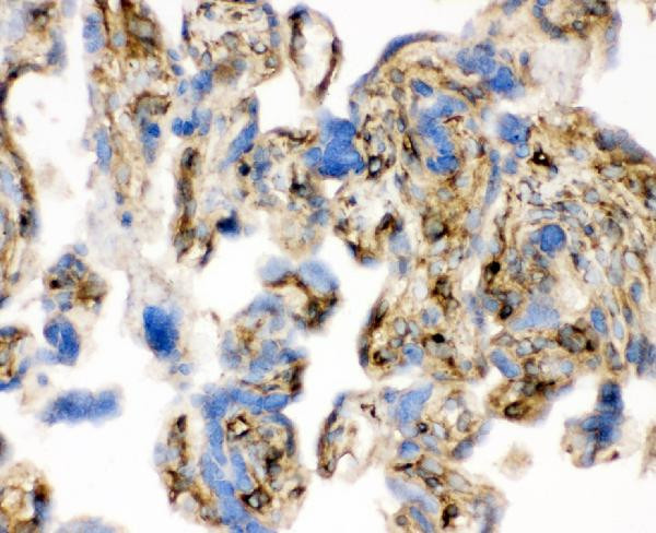 Cofilin Antibody in Immunohistochemistry (Frozen) (IHC (F))