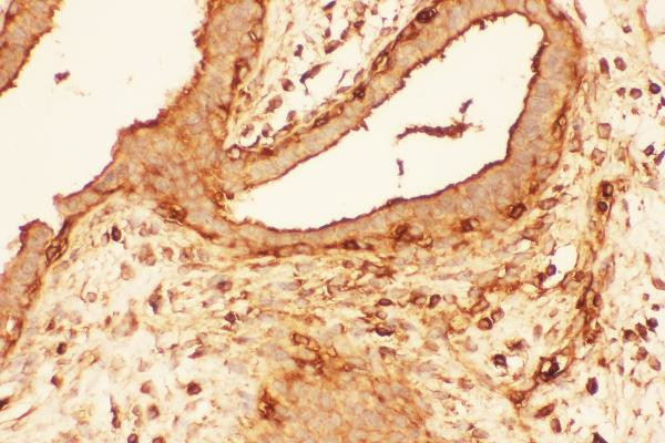 Cofilin Antibody in Immunohistochemistry (Paraffin) (IHC (P))