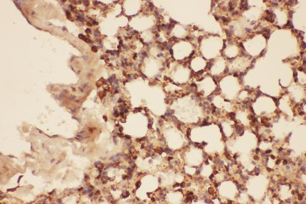 Cofilin Antibody in Immunohistochemistry (Paraffin) (IHC (P))