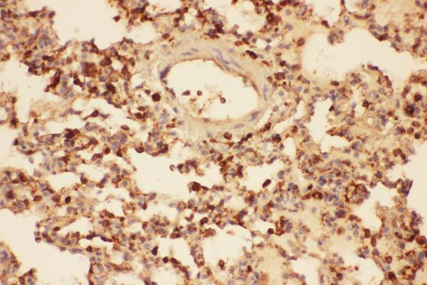 Cofilin Antibody in Immunohistochemistry (Paraffin) (IHC (P))