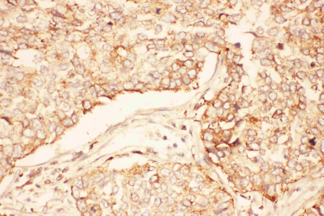 AKT2 Antibody in Immunohistochemistry (Paraffin) (IHC (P))