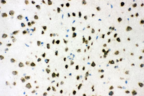 AKT2 Antibody in Immunohistochemistry (Frozen) (IHC (F))