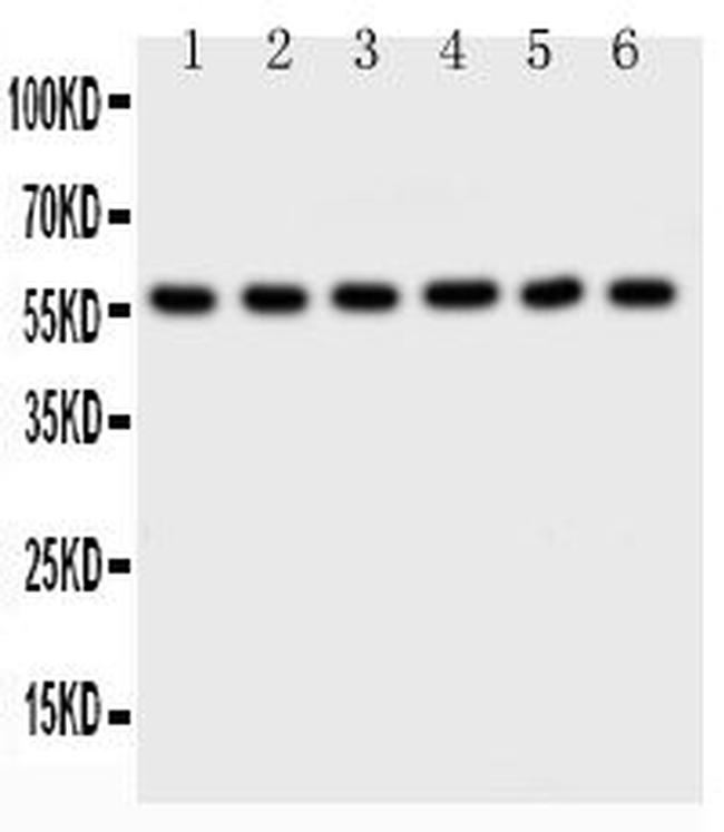 AKT2 Antibody in Western Blot (WB)