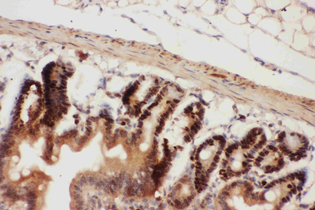 Beclin 1 Antibody in Immunohistochemistry (Paraffin) (IHC (P))