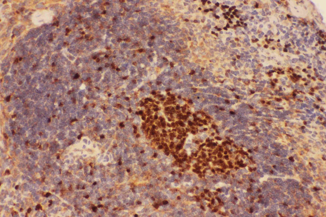 Beclin 1 Antibody in Immunohistochemistry (Paraffin) (IHC (P))