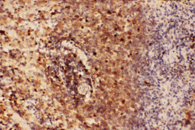 Beclin 1 Antibody in Immunohistochemistry (Paraffin) (IHC (P))