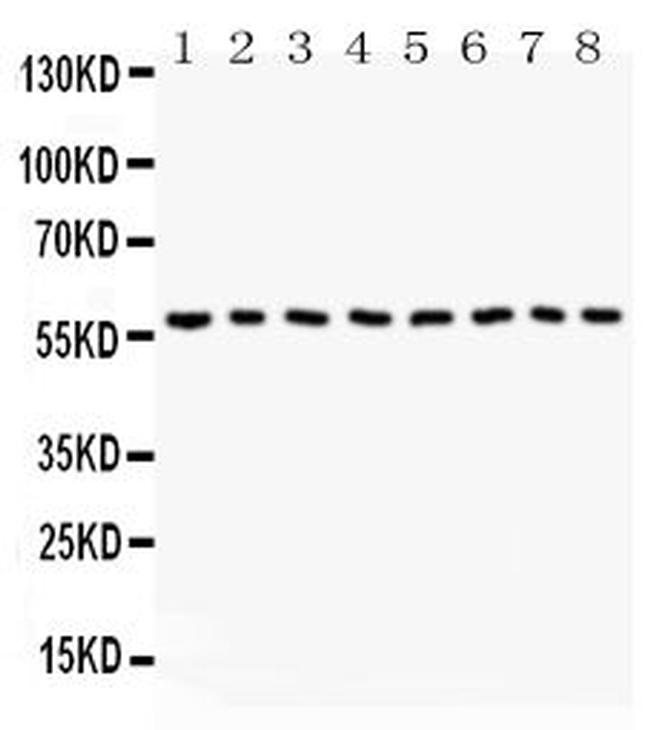 Beclin 1 Antibody in Western Blot (WB)