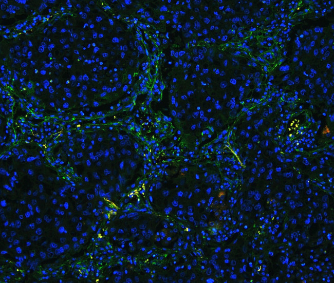 Collagen IV Antibody in Immunohistochemistry (Paraffin) (IHC (P))