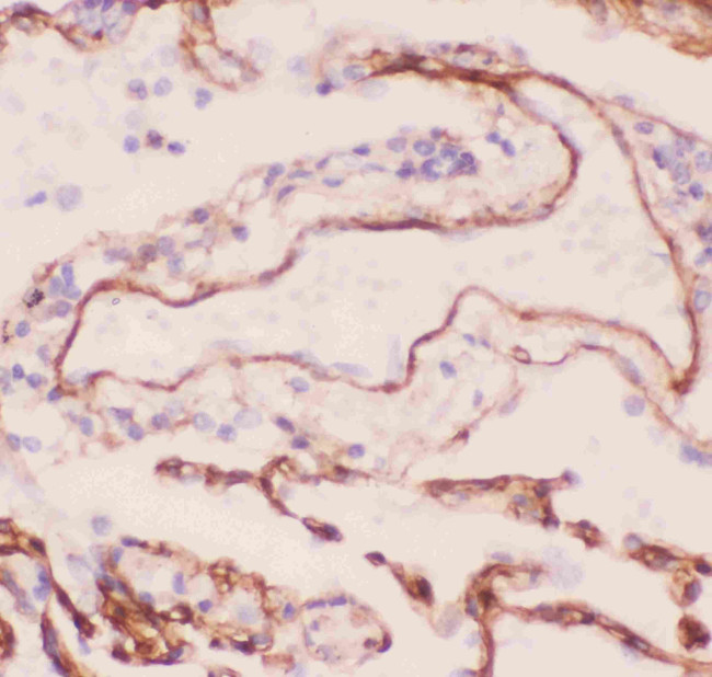 Collagen IV Antibody in Immunohistochemistry (Paraffin) (IHC (P))