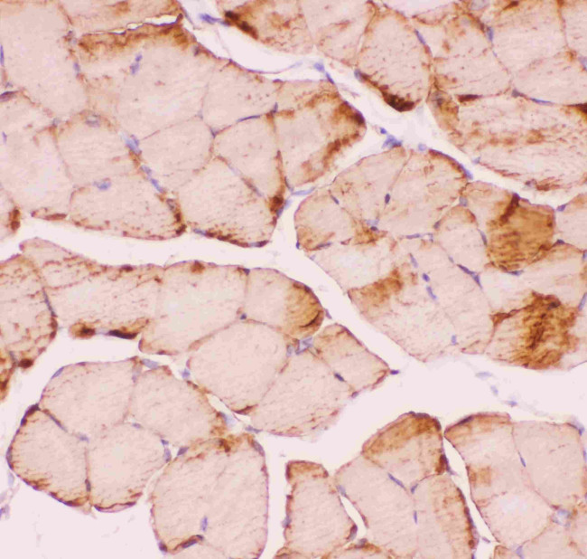 Desmin Antibody in Immunohistochemistry (Paraffin) (IHC (P))