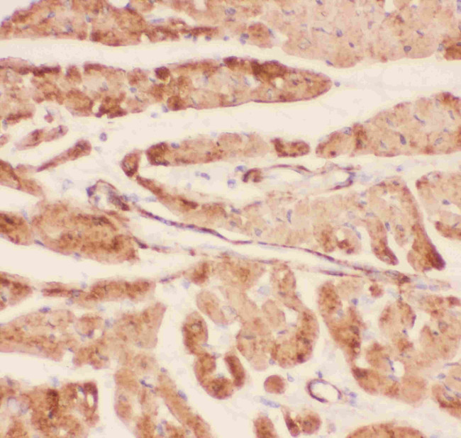 Desmin Antibody in Immunohistochemistry (Paraffin) (IHC (P))