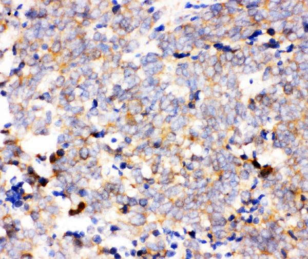 IKK alpha Antibody in Immunohistochemistry (Paraffin) (IHC (P))