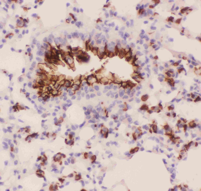 MUC1 Antibody in Immunohistochemistry (Paraffin) (IHC (P))