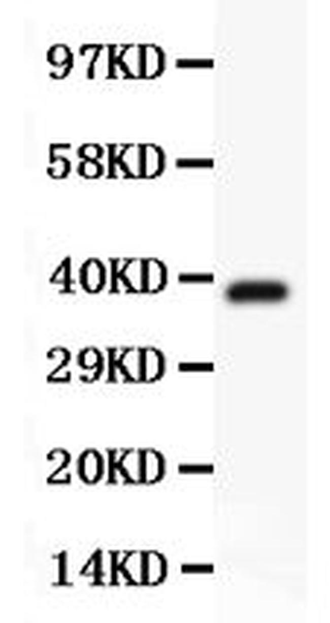 TSC1 Antibody in Western Blot (WB)