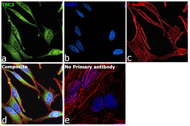 TSC2 Antibody in Immunocytochemistry (ICC/IF)