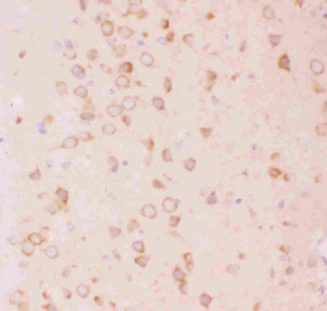 TSC2 Antibody in Immunohistochemistry (Paraffin) (IHC (P))