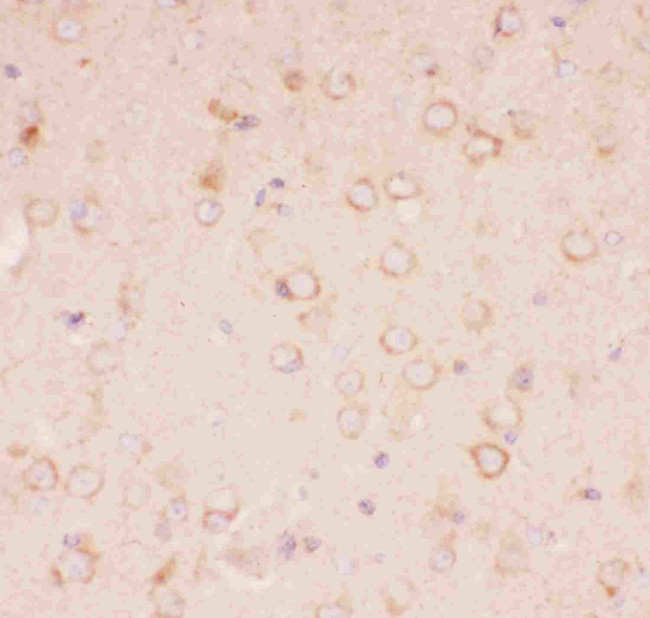 TSC2 Antibody in Immunohistochemistry (Paraffin) (IHC (P))