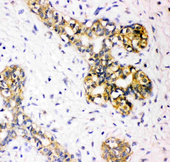 TSC2 Antibody in Immunohistochemistry (Paraffin) (IHC (P))