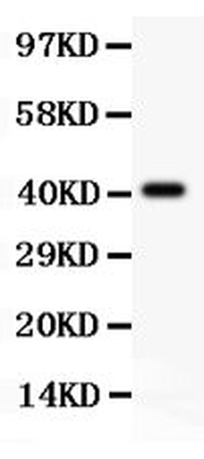 TSC2 Antibody in Western Blot (WB)