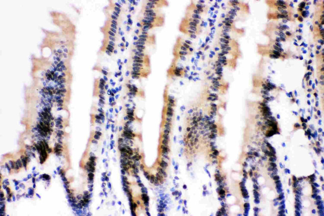 Ubiquitin B Antibody in Immunohistochemistry (Paraffin) (IHC (P))