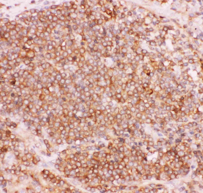 NFkB p52/p100 Antibody in Immunohistochemistry (Paraffin) (IHC (P))