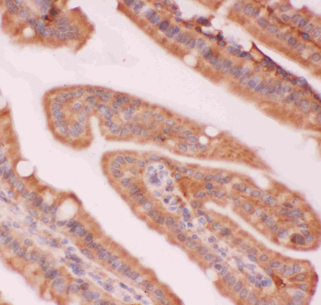 NFkB p52/p100 Antibody in Immunohistochemistry (Paraffin) (IHC (P))