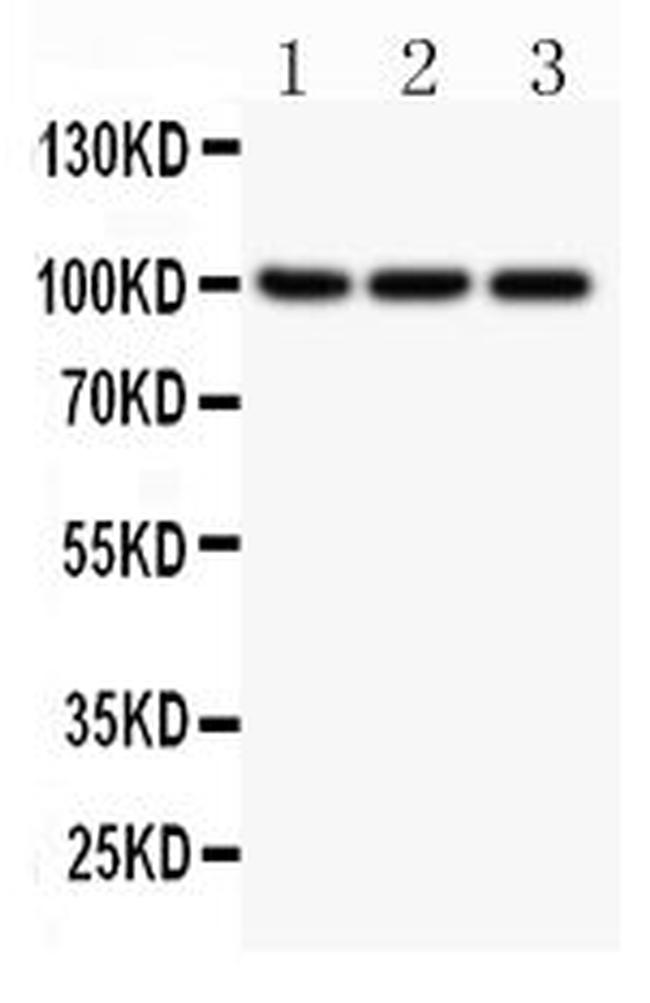 NFkB p52/p100 Antibody in Western Blot (WB)