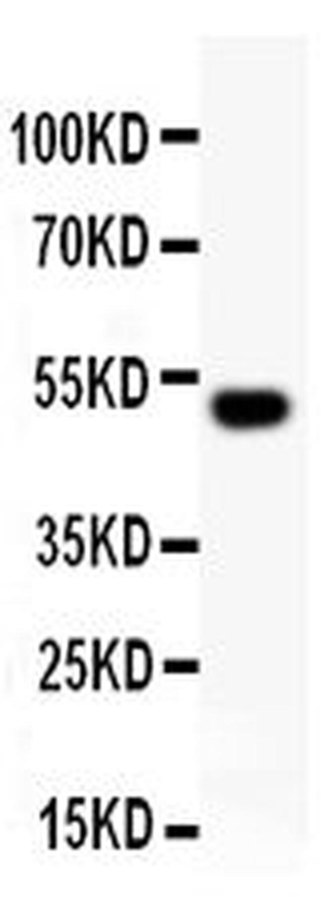 RUNX2 Antibody in Western Blot (WB)