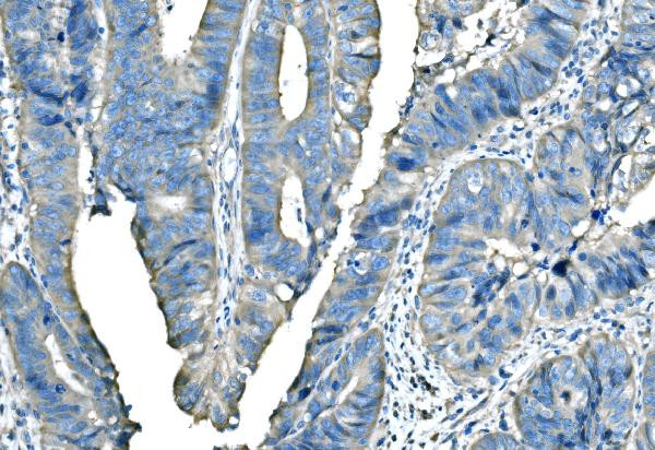 B-Raf Antibody in Immunohistochemistry (Paraffin) (IHC (P))