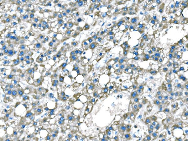 B-Raf Antibody in Immunohistochemistry (Paraffin) (IHC (P))