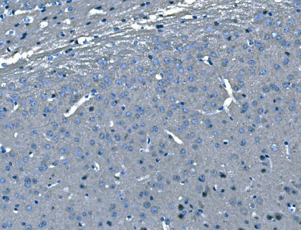 B-Raf Antibody in Immunohistochemistry (Paraffin) (IHC (P))