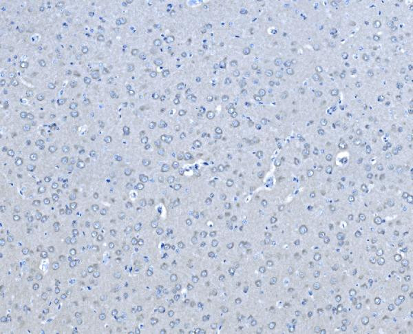 B-Raf Antibody in Immunohistochemistry (Paraffin) (IHC (P))